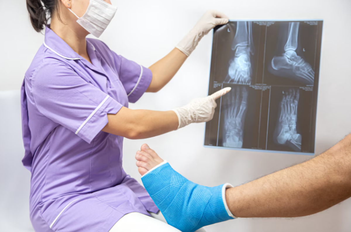 Indian Food for Bone Fracture Healing