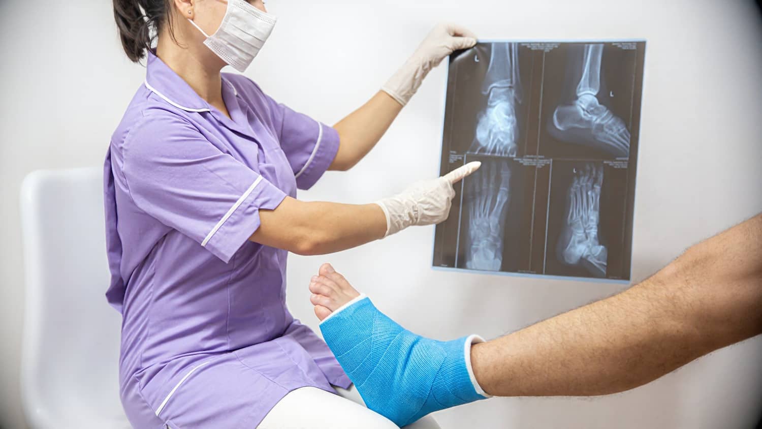 Indian Food for Bone Fracture Healing | Best Diet & Nutrients Doctor reviewing foot X-ray of a fracture patient while discussing Indian food for bone fracture healing.