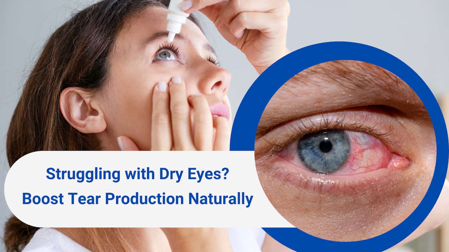 What Is the Treatment of Dry Eyes in Ayurveda? Natural Remedies & Herbal Tips Treatment of Dry Eyes in Ayurveda shown through a woman applying eye drops and a close-up of a red, irritated eye.